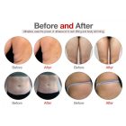 Cryotherapy 6in1